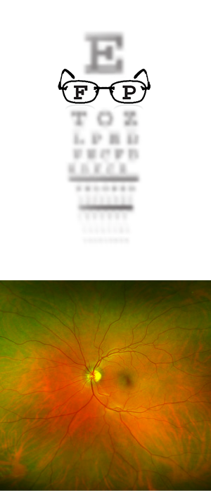 Eye Exams and Optomap Image